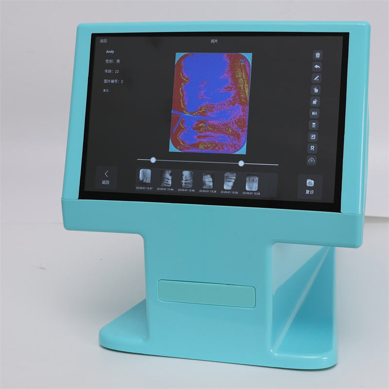 Dynamic DDT-100A Dental Digital Phosphor Plate Scanner PSP X ray Scanner